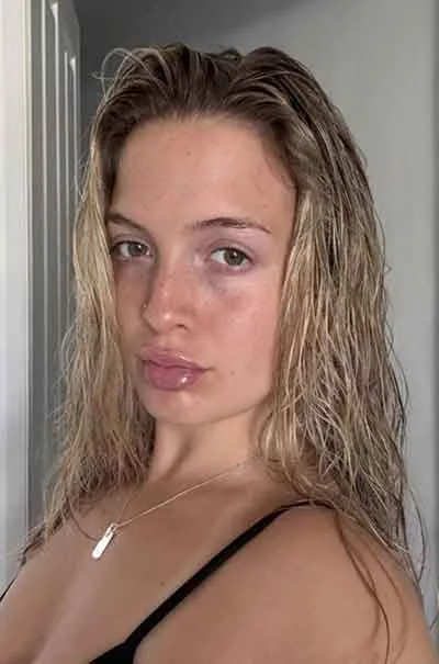 Frida Bergnäset